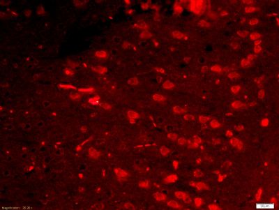 IF - Netrin G1 ligand Polyclonal Antibody AP58495