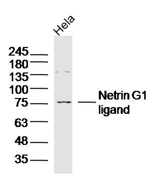 WB - Netrin G1 ligand Polyclonal Antibody AP58495