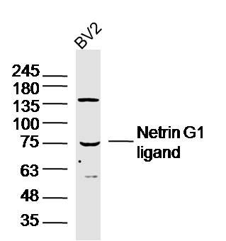 WB - Netrin G1 ligand Polyclonal Antibody AP58495