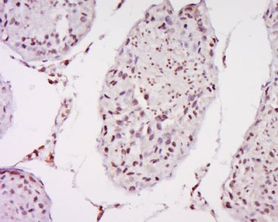 IHC-P - MAGEB1 Polyclonal Antibody AP58520