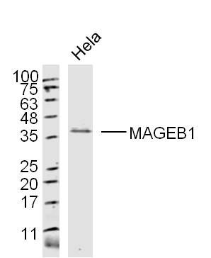WB - MAGEB1 Polyclonal Antibody AP58520