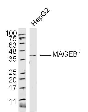 WB - MAGEB1 Polyclonal Antibody AP58520