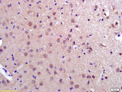 IHC-P - PDCD10 Polyclonal Antibody AP58526