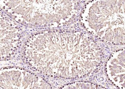 IHC-P - TP53TG5 Polyclonal Antibody AP58722