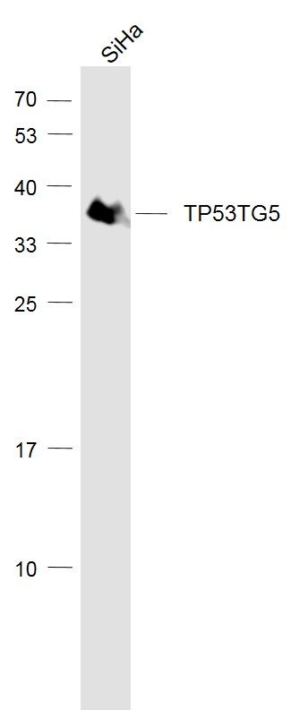 WB - TP53TG5 Polyclonal Antibody AP58722