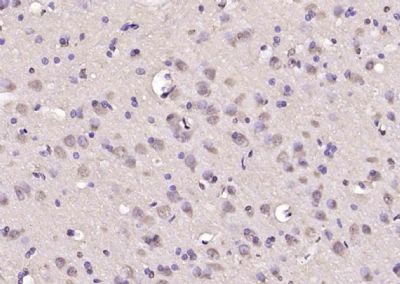 IHC-P - TP53TG5 Polyclonal Antibody AP58722