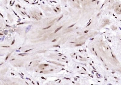IHC-P - BRD7 Polyclonal Antibody AP58751