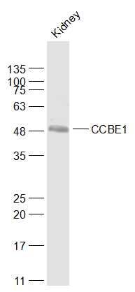 WB - CCBE1 Polyclonal Antibody AP58823