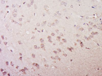 IHC-P - VGLUT3/SLC17A8 Polyclonal Antibody AP59066