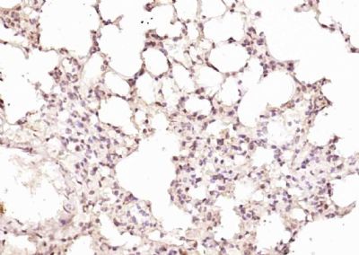 IHC-P - RPUSD2 Polyclonal Antibody AP59311
