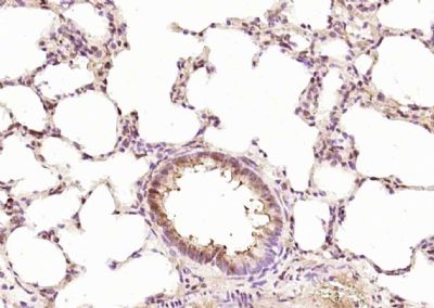 IHC-P - RPUSD2 Polyclonal Antibody AP59311