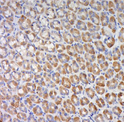 IHC-P - C11ORF77 Polyclonal Antibody AP59429