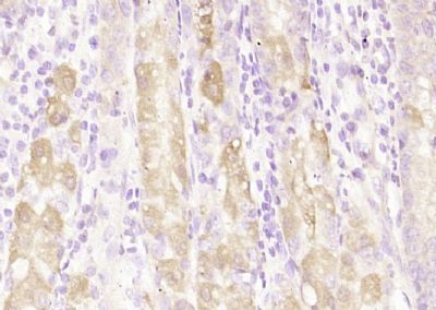 IHC-P - C21orf70 Polyclonal Antibody AP59452