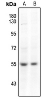 WB - Anti-SMAD3 (pS204) Antibody AP59615