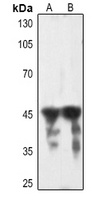WB - Anti-cTnT Antibody AP59721