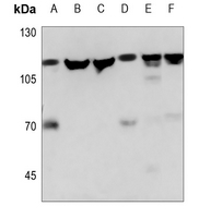 WB - Anti-NAA15 Antibody AP59875