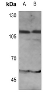 WB - Anti-IFNAR1 (pY466) Antibody AP60017