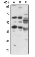 WB - Anti-OCTN1 Antibody AP60194