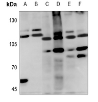 WB - Anti-Cadherin 19 Antibody AP60244