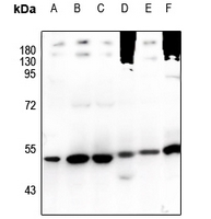 WB - Anti-TRIM38 Antibody AP60412