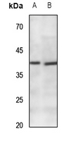 WB - Anti-CACNG7 Antibody AP60437