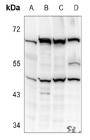 WB - Anti-Kir2.1 Antibody AP60474