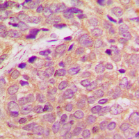 - Anti-RB3 Antibody AP60639