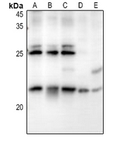 WB - Anti-RB3 Antibody AP60639