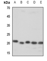 WB - Anti-ZNF695 Antibody AP60655