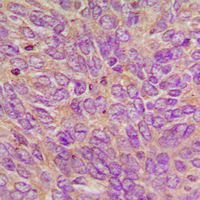  - Anti-GCP6 Antibody AP60691