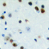 - Anti-ZC3H7B Antibody AP60731