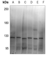 WB - Anti-ZC3H7B Antibody AP60731