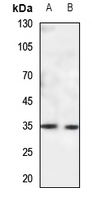 WB - Anti-CACNG5 Antibody AP60825