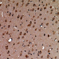  - Anti-AAK1 Antibody AP60850