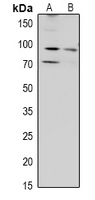 WB - Anti-ZAK Antibody AP60939