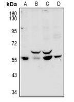 WB - Anti-PPP1R16B Antibody AP60981