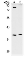 WB - Anti-TSSK4 Antibody AP61006