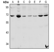 WB - Anti-HSPBAP1 Antibody AP61022