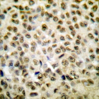  - Anti-Histone H1oo (AcK163) Antibody AP61134