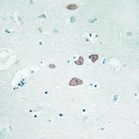  - Anti-STON1 Antibody AP61319