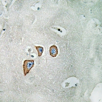  - Anti-NMDAR2C Antibody AP61362