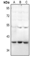 WB - Anti-HEXO Antibody AP61399