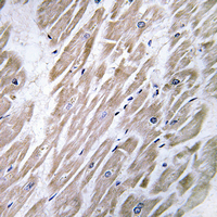 - Anti-KANK2 Antibody AP61469