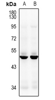 WB - Anti-CACNG8 Antibody AP61473