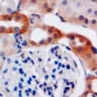 - Anti-C4BP beta Antibody AP61631
