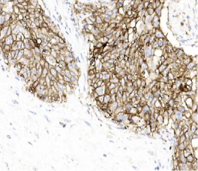 IHC-P - Recombinant PD-L1 antibody [AC37] AP80075