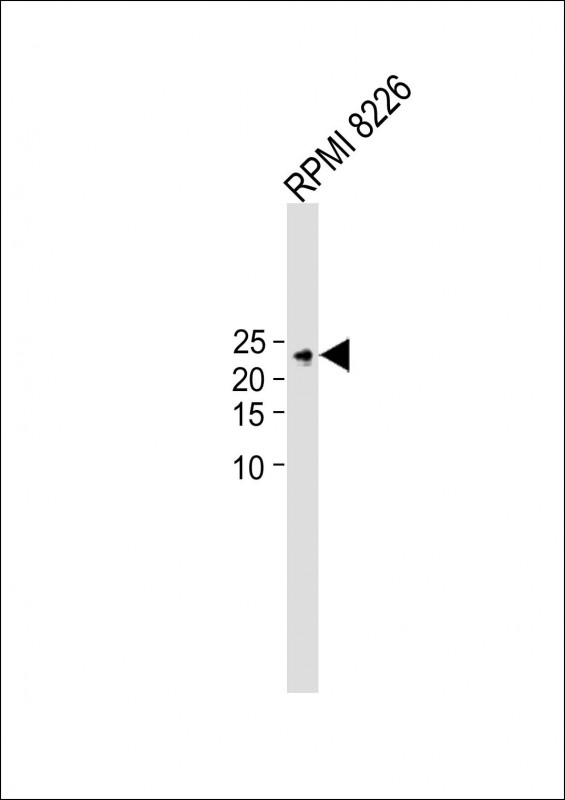 WB - TIFA Antibody (N-term) AP9587a