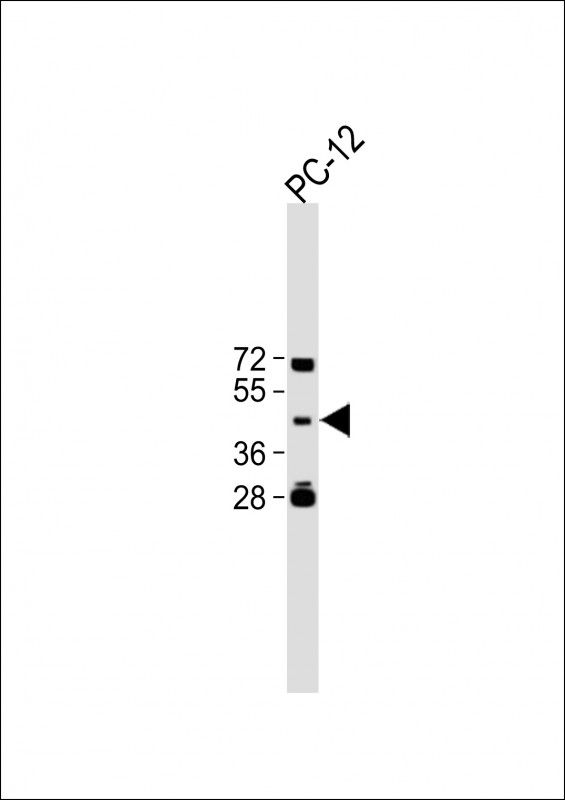 WB - TBC1D13 Antibody (Center) AP11876c