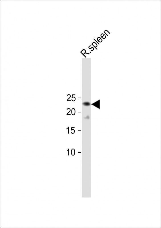 WB - TRGC2 Antibody (N-term) AP19092a