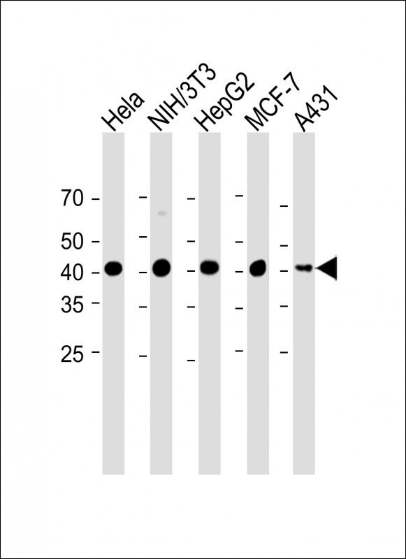WB - Beta-actin Antibody (Ascites) AM1021a
